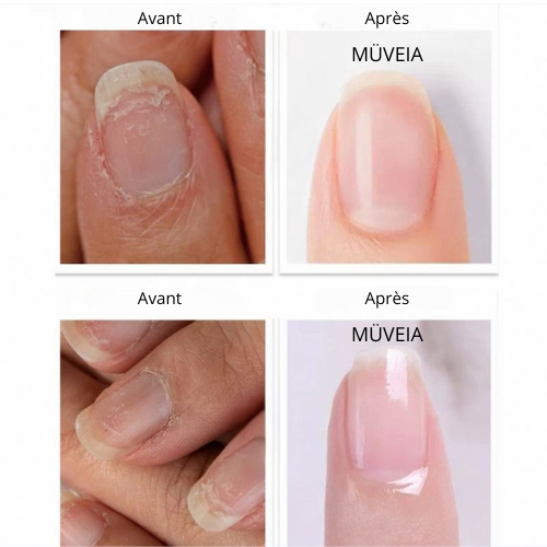 Soin antifongique & éclat des ongles – Mains & Pieds