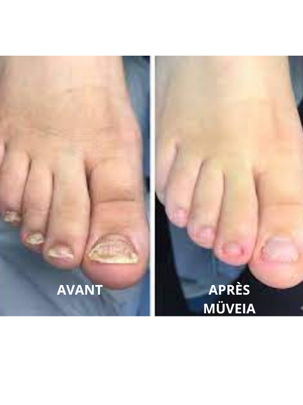 Soin antifongique & éclat des ongles – Mains & Pieds